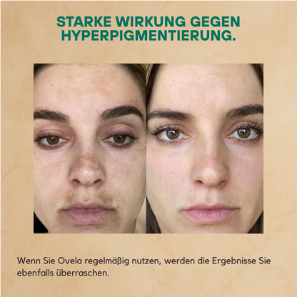Ovela Anti-Aging  Schafschwanzfett Creme
